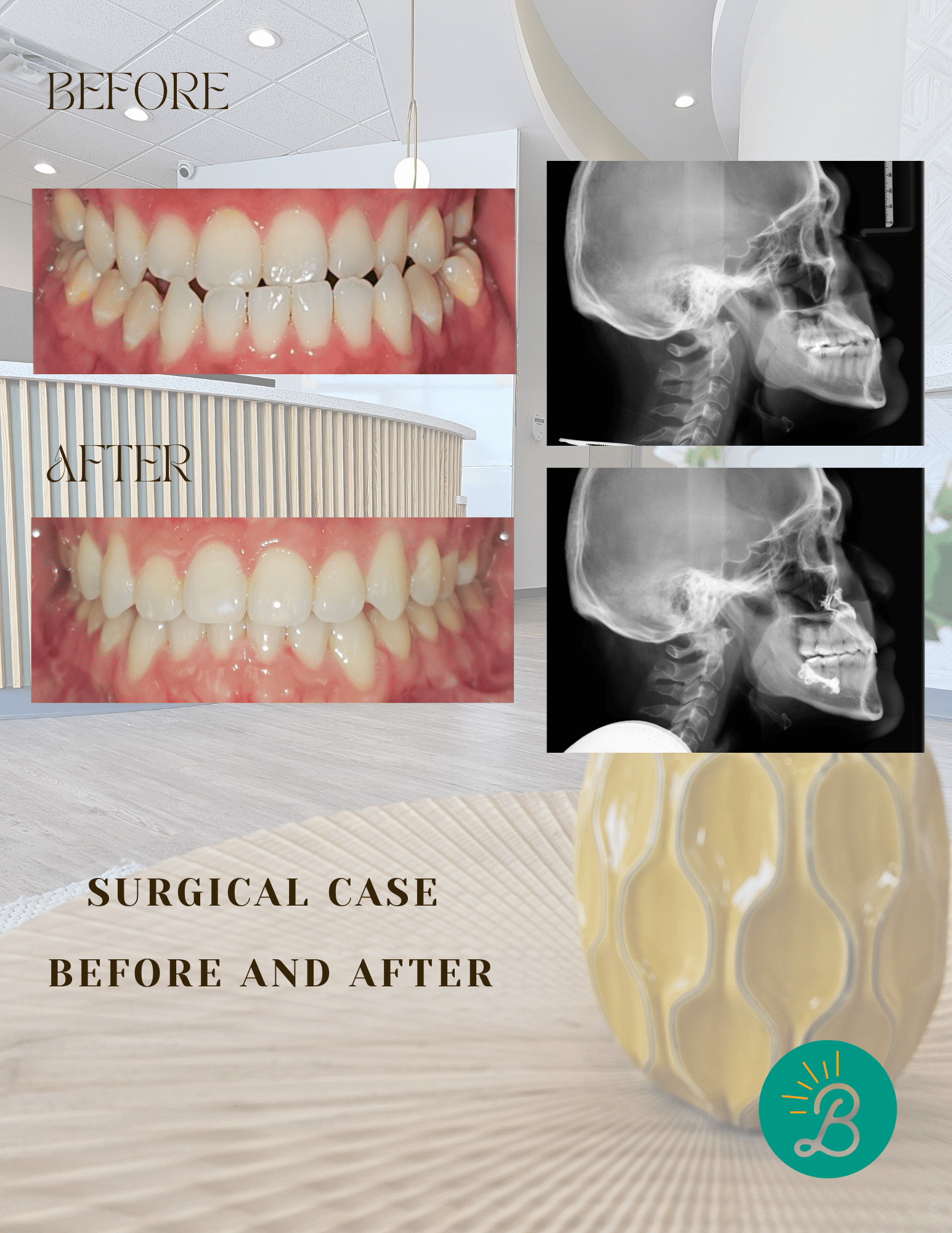 Brightside Braces Image 4